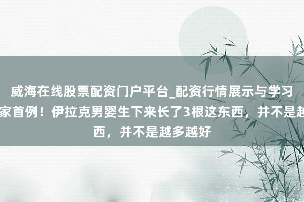 威海在线股票配资门户平台_配资行情展示与学习导航 大家首例！伊拉克男婴生下来长了3根这东西，并不是越多越好